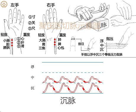 脈象圖